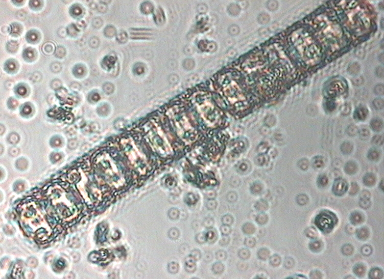 Dictyocha speculum